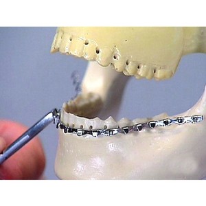 Instruments dentaires électriques en acier inoxydable pour barres d'arche, implants, fils Erich, fixation de la mâchoire, outils orthodontiques, certifiés CE classe II - Product Image 2