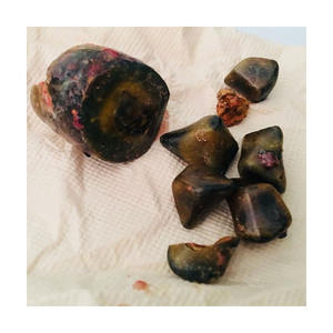 Pierres biliaires en pierre noire à bas prix idéales pour les tests d'extraction et de laboratoire - Product Image 4