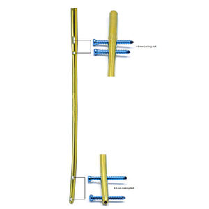 Juego de Instrumentos de Implantes Ortopédicos de Alta Calidad con Clavos de Bloqueo Femoral Manuales Personalizables para Cirugía Ortopédica - Product Image 4