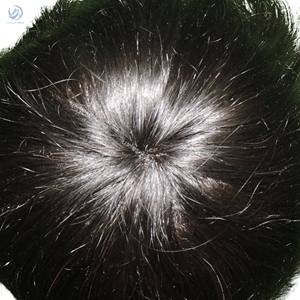 Tupé Mirage Border Premium para hombres Parche de cabello Remy indio con técnica de PU Grado de cabello de alta calidad - Product Image 5