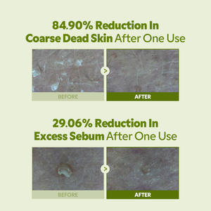 Exfoliante Facial de Té de Burbujas Matcha - Product Image 4