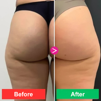 Crème Rosa Adeus 300g - Crème corporelle multifonctionnelle intensive - Anti-cellulite, traitement des vergetures et raffermissement de la peau