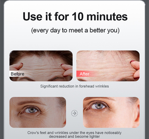 2024 Thiết Kế Mới Chuyên Nghiệp Xu Hướng Sản Phẩm Skincare Wand Home Sử Dụng Vẻ Đẹp Thiết Bị 4-Trong-1 Rạng Rạng Rạng Đổi Mới Mắt Skincare Wand - Product Image 4