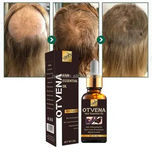 定制标志橄榄油头发头皮油有机天然头皮生发按摩油