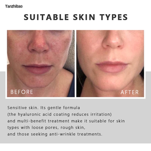 Axit Hyaluronic huyết thanh EGF & Adenosine giữ ẩm Hàn Quốc OEM chăm sóc da huyết thanh 1.69 FL. OZ/50ml - Product Image 2