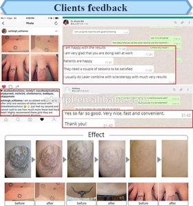 Machine de bureau fixe pour le traitement des tatouages au laser Nd YAG, le traitement des pigments, le <span class=keywords><strong>peeling</strong></span> au carbone, le blanchiment de la peau au laser Pico, l'élimination des taches de rousseur - Product Image 6
