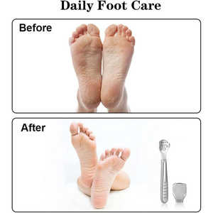Cortador de callos de alta calidad, removedor de piel dura muerta, removedor de callos de pie de acero inoxidable - Product Image 5