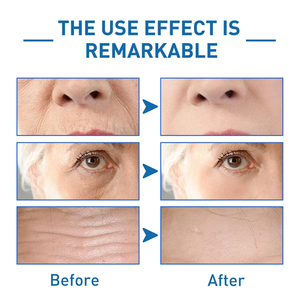 Venta al por mayor <span class=keywords><strong>Hyalu</strong></span> <span class=keywords><strong>B5</strong></span> cuidado de la piel Facial Lift reafirmante hidratante reparación blanqueamiento ácido hialurónico antiarrugas envejecimiento suero facial - Product Image 4