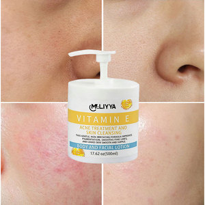 <span class=keywords><strong>Crema</strong></span> Trattamento Acne MALYYA alla Vitamina E 300ml Extra con Burro di Cacao, Idratazione <span class=keywords><strong>48</strong></span> Ore, <span class=keywords><strong>Crema</strong></span> Nutriente Extra OEM/ODM - Product Image 2