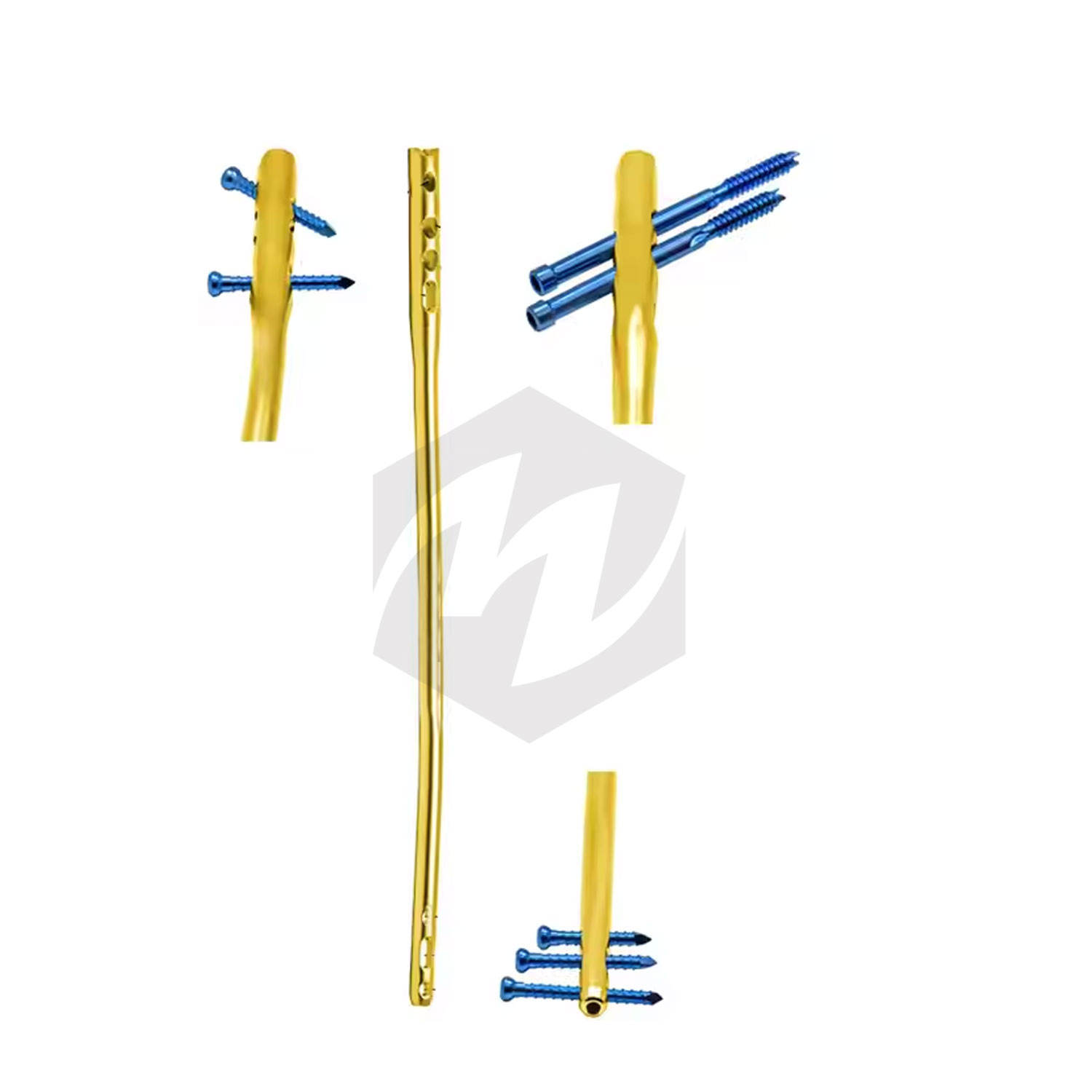 ชุดศัลยกรรมกระดูก