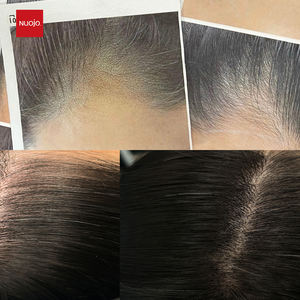 Impression du <span class=keywords><strong>cuir</strong></span> <span class=keywords><strong>chevelu</strong></span> SMP <span class=keywords><strong>tatouage</strong></span> peau débutant pratique <span class=keywords><strong>cuir</strong></span> <span class=keywords><strong>chevelu</strong></span> féminin micropigmentation pratique peau - Product Image 4