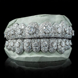 Grillz Moissanite Iced Out en Argent 925 Plaqué Rhodium, Luxe, Sur Mesure, Unisexe, Bijou de Sourire Tendance, Grillz Argenté - Product Image 3