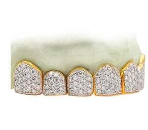 6 piezas de diamantes para niños plata esterlina sólida chapada en oro frente abierto cara incisivos colgantes encantos 10K 14K Rosa Blanca - Product Image 2