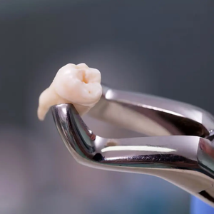 Meilleures ventes en gros, forceps d'extraction dentaire de haute qualité, ensemble d'instruments chirurgicaux en acier inoxydable, poignée rembourrée de luxe, CE - Product Image 6