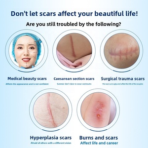 Molho de ferida transparente médico profissional Waterproof Scar Removal Silicone Tape Roll Respirável Scar Adhesive - Product Image 4