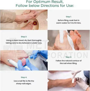 ชุดเครื่องมือโพไดเอทรีสแตนเลสแบบแมนนวลน้ำหนักเบาสำหรับการศัลยกรรมบนร่างกายเครื่องมือทางการแพทย์ - Product Image 2