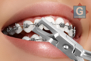 Alicates de Acero Inoxidable de Primera Calidad para Remover Brackets de Ortodoncia Manuales -6112-07, Certificación CE - Product Image 6