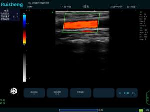 DYX Hoogwaardige draagbare veterinaire echografie <span class=keywords><strong>Doppler</strong></span>-apparaat Prijs voor dieren - Product Image 4