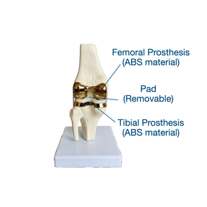 Modelo de prótesis de rodilla Artificial desmontable de calidad superior conjunto de modelo de implante de articulación de rodilla dorado pequeño único hecho en Pakistán - Product Image 4
