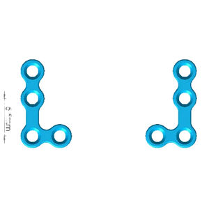 Implante Maxilofacial de Alta Calidad Tipo Z, Implante Confiable para Reconstrucción Facial, Implantes Quirúrgicos Ortopédicos Veterinarios - Product Image 2