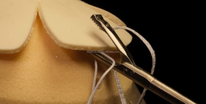 Passeur de suture pour la manchette des rotateurs d'arthroscopie de l'articulation de l'épaule et la réparation du labral, instrument orthopédique chirurgical de type scorpion - Product Image 6