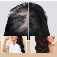 Complément capillaire à base de plantes OEM pour améliorer la croissance des cheveux, favoriser une croissance rapide des cheveux chez la femme, soutenir la lutte contre la chute des cheveux et prendre soin des cheveux