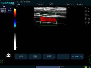 DYX Hoogwaardige draagbare veterinaire echografie <span class=keywords><strong>Doppler</strong></span>-apparaat Prijs voor dieren - Product Image 5