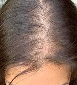 100% Human <b>Hair</b> <b>Toppers</b> & Patches - Product Image 5