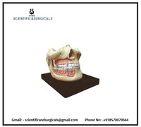 Modèle de prothèse dentaire adulte en acrylique blanc CISCO pour l'enseignement en laboratoire de biologie, pour la simulation de dents manquantes
