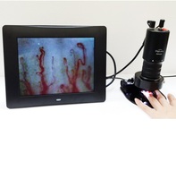DigiLens DMX 980-1 Microcirculation sanguine pour machine avec microscope vidéo et tube trinoculaire pour la santé