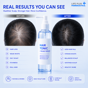 Tónico Capilar, Suero para el Cuero Cabelludo de Marca Privada, Líquido Hidratante y Nutritivo para el Cuidado Diario del Cabello - Product Image 6
