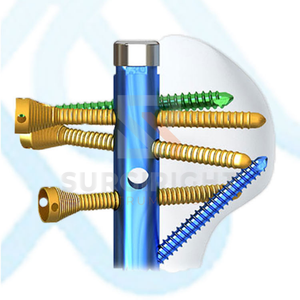 Implantes ortopédicos para traumatismos Clavo de titanio entrelazado Clavo intramedular humeral de bloqueo múltiple de Surgiright - Product Image 4
