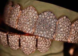 Grillz personnalisé en or rose entièrement serti de diamants pour les dents supérieures et inférieures, pierres simulées VVS1, bijoux de bouche Hip Hop - Product Image 4