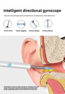منظار أذن داخلي عالي الجودة مع كاميرا صغيرة مقاومة للماء لإزالة شمع الأذن بأمان ورؤية واضحة - Product Image 5