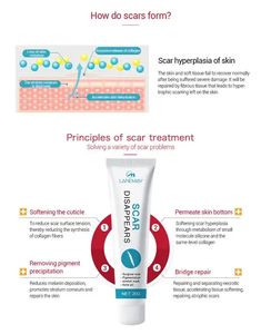 Verwijder Acne Littekencrème Tcm Litteken En Acne Litteken Verwijdering Gel Zalf <span class=keywords><strong>Burn</strong></span> <span class=keywords><strong>Removal</strong></span> Crème Voor Spotbehandelingen - Product Image 5