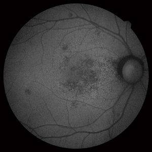 Tomographie de cohérence optique / Caméra de fond d'œil Scan Duo 2 à prix réduit, tout neuf - Product Image 3