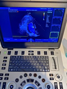 Sistema de Diagnóstico por Imágenes de Ultrasonido Portátil Premium, Escáner Médico para Cardiología y Radiología - Product Image 4