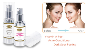 Crème éclaircissante à l'acide lactique et 10% de vitamine A, exfoliant au gel d'aloe vera pour le soin du visage - Product Image 4