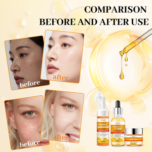 OEM VC Serum Skin Care Hyaluronic Acid <b>Face</b> Serum Natural Organic Aging Whitening Vitamin C Serum - Product Image 3