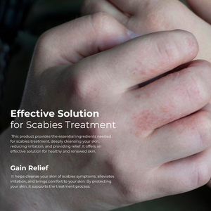 Champú TTO Thermal Black para cabello y cuerpo 500ml, champú limpiador con ácido salicílico y aceite de árbol de té para cuero cabelludo graso y caspa. - Product Image 3