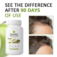 Produits favorisant la croissance des cheveux, hautement efficaces, Pousse Cheveuxrapide, multivitamines pour la croissance des cheveux, comprimés pour la croissance des cheveux, femmes, hommes
