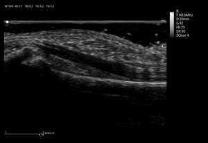 Sistem Diagnostik Rumah Sakit Kelas Atas <span class=keywords><strong>4d</strong></span> Cart Color Doppler <span class=keywords><strong>Ultrasound</strong></span> untuk Penggunaan Manusia atau Hewan Peralatan MSLCU50 - Product Image 6