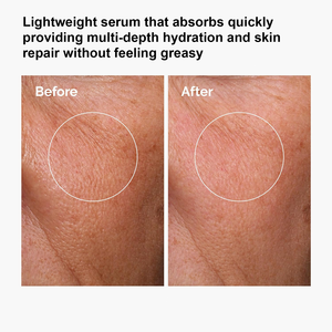 Suero Facial de Ácido Hialurónico + <span class=keywords><strong>B5</strong></span> de Marca Privada 1oz - Hidratación Profunda y Reparación de la Barrera Cutánea con Ceramida para una Piel Más Tersa y Voluminosa - Product Image 6