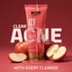 Espuma Limpiadora Facial con Ácido Salicílico para Todo Tipo de Piel, Tratamiento para el Acné, Limpieza Profunda y Reafirmante, 100 ml - Product Image 3