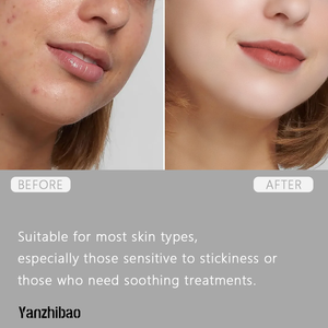 100mL Centella Face Ampoule Calmante Hidratante-Cápsula de brillo Suero para pieles sensibles Cuidado de la piel de gran tamaño - Product Image 5