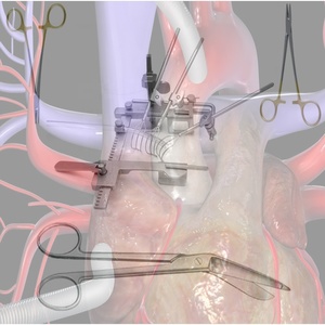 ENSEMBLE DE CHIRURGIE À COEUR OUVERT CARDIAQUE Complet Professionnel 95 PCS Instruments Chirurgicaux Médicaux A + Qualité PAR DADDY D PRO CE & ISO - Product Image 6