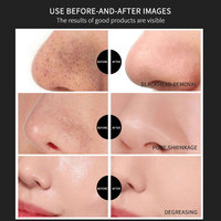 Masque Nasal Minéral Tendance : Bandes Nettoyantes Profondes pour Points Noirs et Réduction des Pores