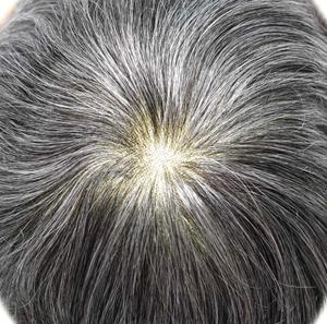 วิกผมสำหรับผู้ชายผมปลอมหนัง PU บางพิเศษทำจากเส้นผมธรรมชาติ - Product Image 3