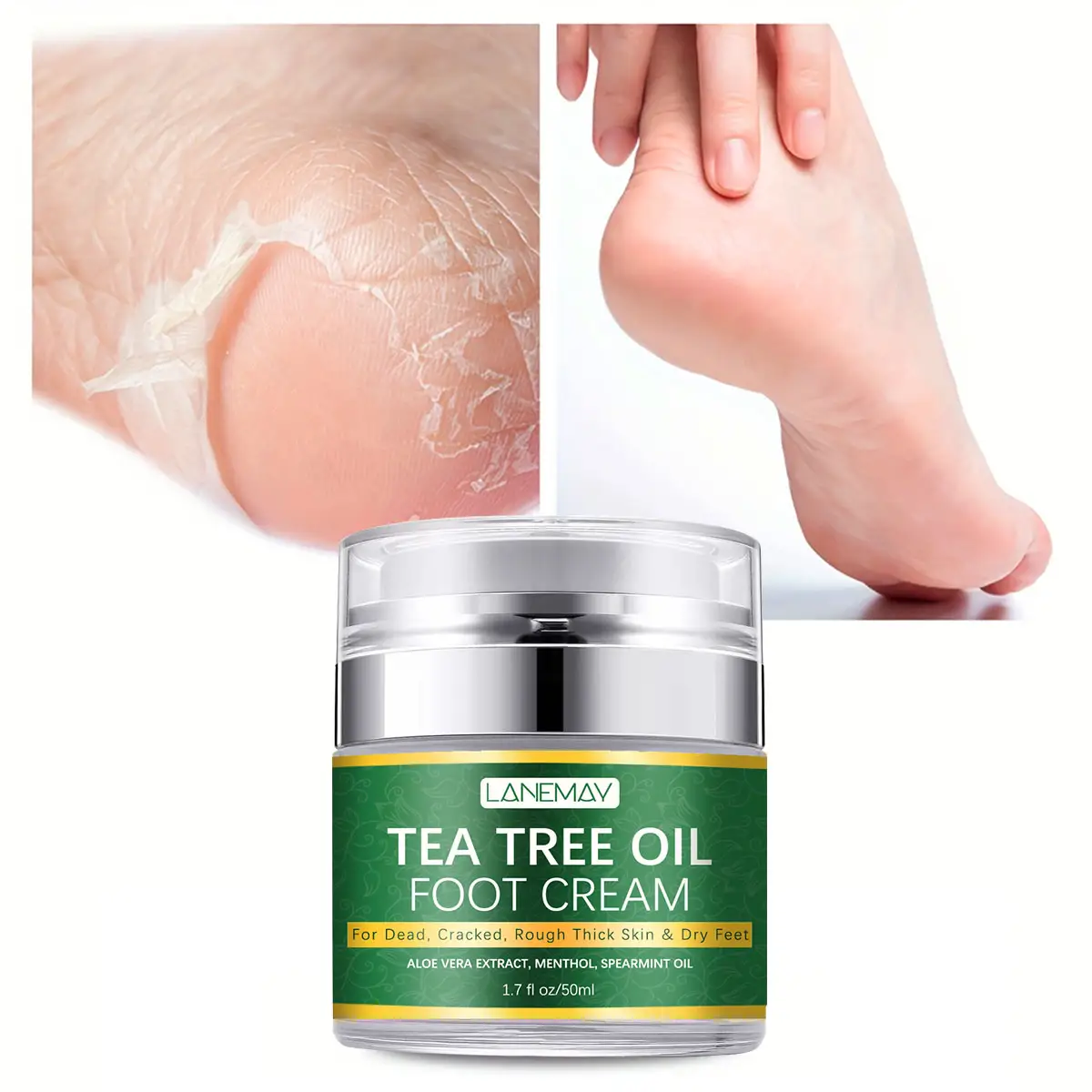 Crème réparatrice pour les pieds en gros UREA peau sèche hydrater crème adoucissante pour les pieds callosités personnaliser pour la crème antifongique pour les pieds