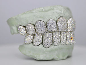 Hip Hop Personalidad Grillz Dientes Top Bottom Set con VVS Clarity Moissanite Diamond Iced Out Custom 925 Sterling Silver Grillz - Product Image 3